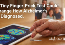 finger prick blood test trial for early alzheimer diagnosis in older adults