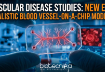 Discover the "Vessel-Chip" Models that uses living cells & complex anatomy to recreate how Vascular Disease starts in the human body.
