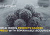 New AI Model Could Help Doctors Predict Cancer Spread With Remarkable Accuracy AI model used in cancer research analyzing gene data to predict cancer metastasis and tumor spread risk.