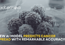 AI model used in cancer research analyzing gene data to predict cancer metastasis and tumor spread risk.