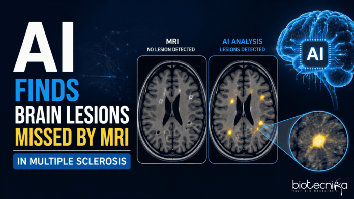 AI Finds Brain Lesions Missed by MRI in Multiple Sclerosis AI revealed more than 11,000 Hidden Brain Lesions in Multiple Sclerosis patients, Exposing Damage that Standard MRI Scans Failed to Detect.